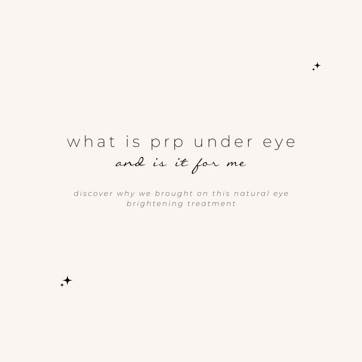 —bright eyes, naturally: everything you need to know about prp for under eyes